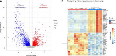 Comparative Transcriptome Analyses Reveal a Transcriptional Landscape of Human Silicosis Lungs and Provide Potential Strategies for Silicosis Treatment